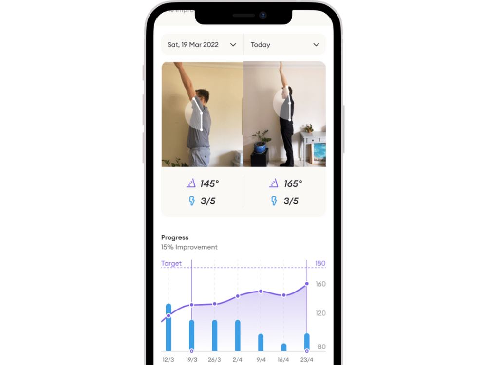 Siphox Health - Compare your results App image of Compare frozen shoulder images in Siphox Health app