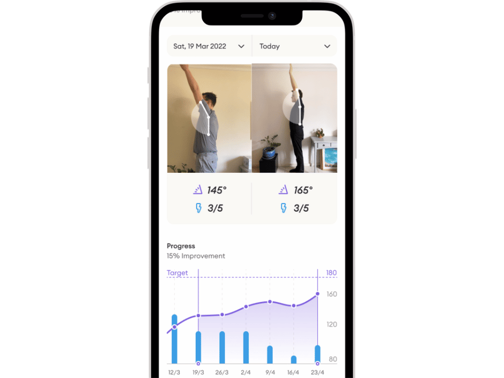 Compare shoulder range of motion in Siphox Health app