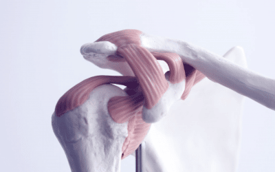 Shoulder dislocation and shoulder separation.